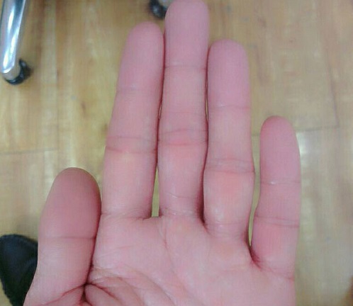 Kiem tra kha nang khe ho ban tay de biet tai van hinh anh 2