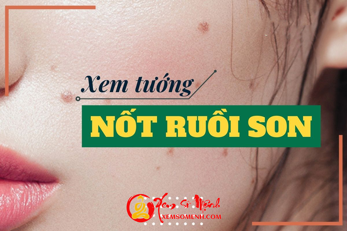 NỐT RUỒI SON thực sự có đem lại vận đỏ và may mắn cho chủ nhân?