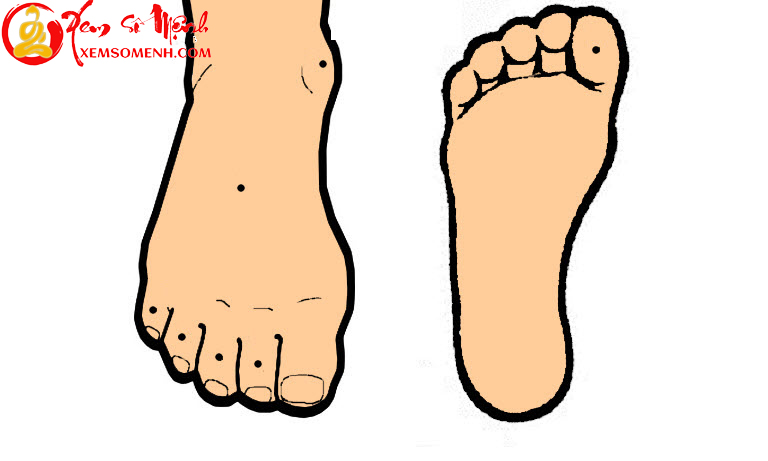 Mãi không thể giàu lên vì sở hữu những nối ruồi này ở bàn chân