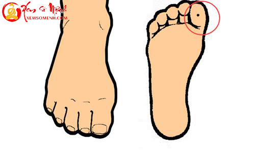 not ruoi duoi ngon chan cai