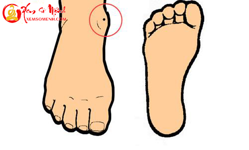 not ruoi o mat ca chan