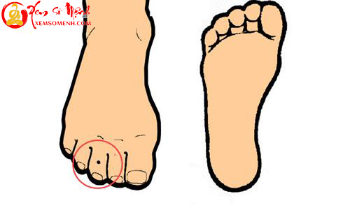 not ruoi tren ngon chan giua