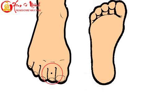 not ruoi tren ngon chan thu 2