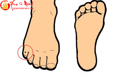 not ruoi tren ngon chan ut