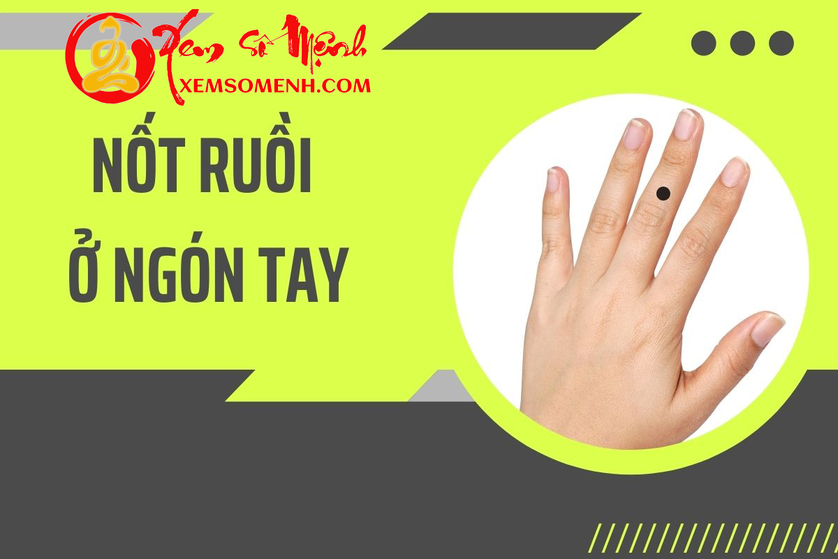 Giải mã tất tần tật về nốt ruồi trên ngón tay