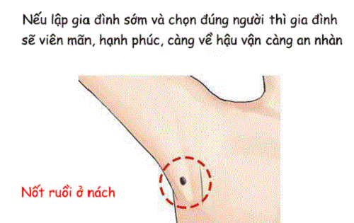 Nốt ruồi phú quý ở nách Not ruoi phu quy o nach