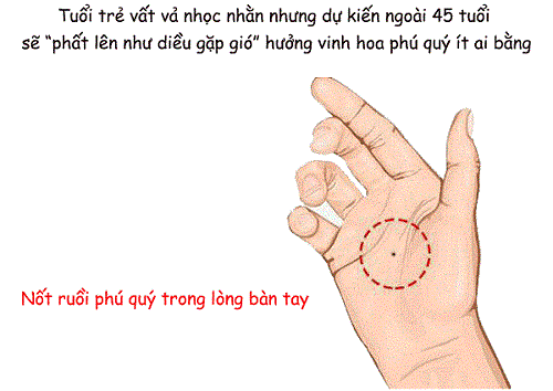 Nốt ruồi nằm trong lòng bàn tay Not ruoi nam trong long ban tay
