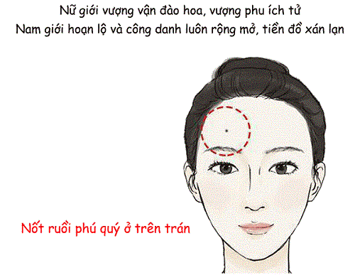 Nốt ruồi ở trên trán được coi là quý tướng Not ruoi o tren tran duoc coi la quy tuong