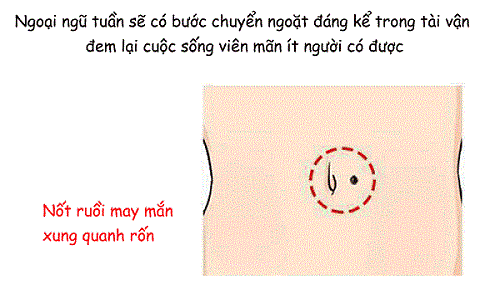 Nốt ruồi ở xung quanh rốn Not ruoi o xung quanh ron