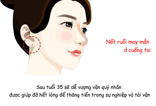 Vị trí nốt ruồi ở cuống tai Vi tri not ruoi o cuong tai