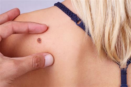 not ruoi sau vai not ruoi sau vai