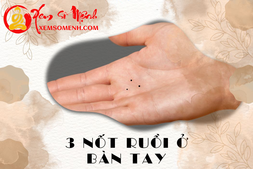 3 not ruoi trong ban tay