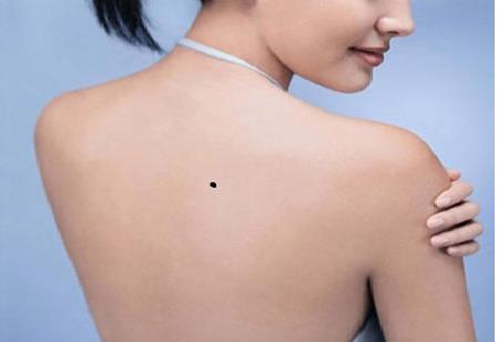 Có được nốt ruồi phú quý này, cả đời không phải lo phiền