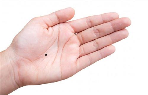 Có được nốt ruồi phú quý này, cả đời không phải lo phiền hình ảnh Co duoc not ruoi phu quy nay, ca doi khong phai lo phien hinh anh