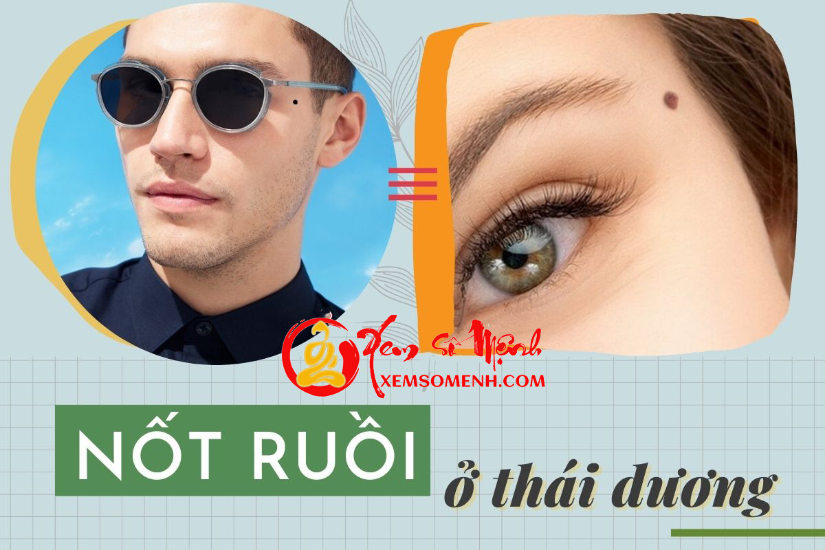 Nốt Ruồi Ở Thái Dương: Dấu Hiệu Của Tài Lộc Hay Thử Thách Trong Cuộc Đời