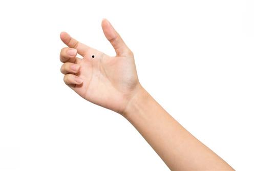 Nốt ruồi ở lòng bàn tay Not ruoi o long ban tay