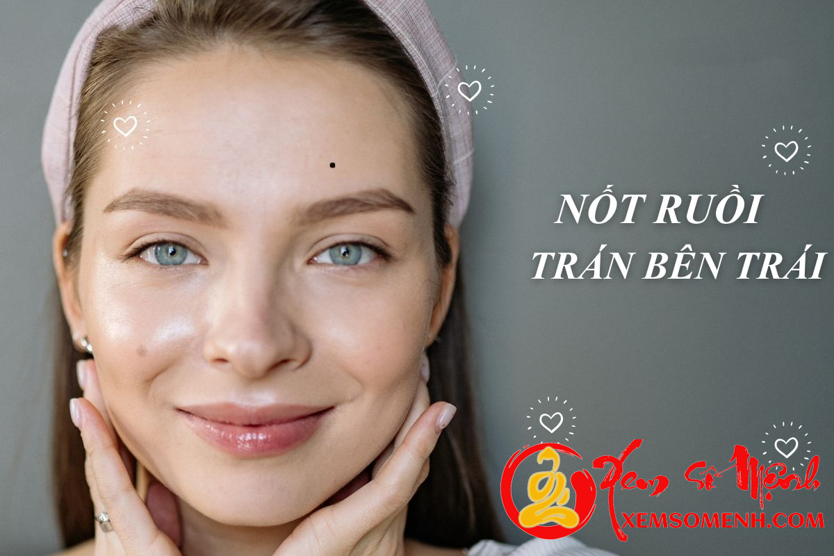 Not ruoi o tran ben trai - Nu gioi ky not ruoi o vi tri nao