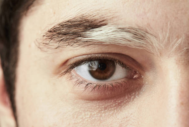 Lông mày của bạn đột nhiên mọc sợi lông TRẮNG