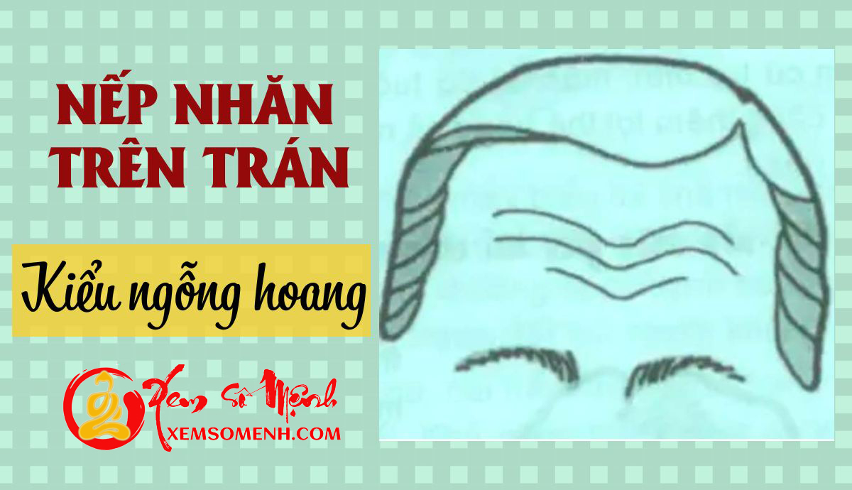 Nếp nhăn kiểu ngỗng hoang