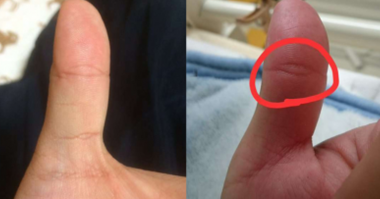 Có Vân Mắt Phật Trên Tay: Phước Lành Trời Ban, Cuộc Đời Bình An Tự Tại