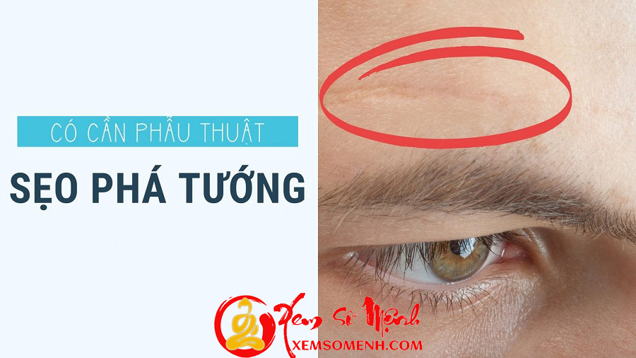 Seo pha tuong tren co the