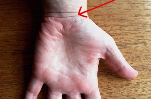 Dự đoán tương lai sướng khổ giàu nghèo qua đường vân cổ tay