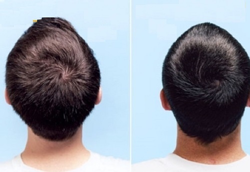 Giải Mã Xoáy Tóc: Hé Lộ Đường Đời & Cá Tính Ẩn Giấu Bên Trong Bạn