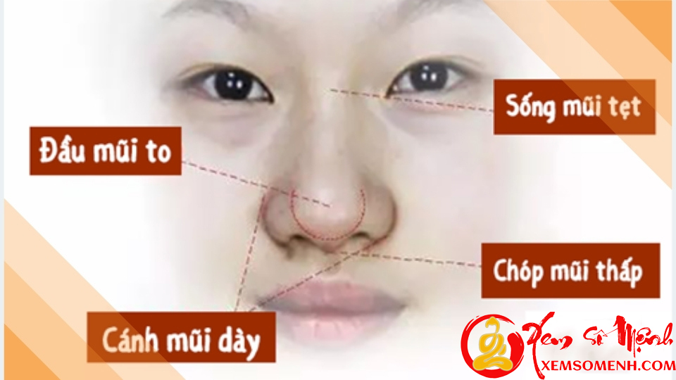 Tướng mũi củ tỏi xấu xí nhưng đầy phúc khí, đừng dại mà sửa kẻo mất lộc