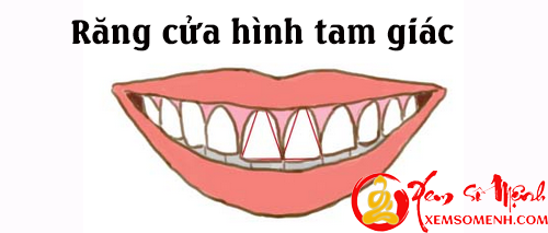 Tuong rang cua tiet lo ban chat con nguoi thuc su cua ban hinh anh goc