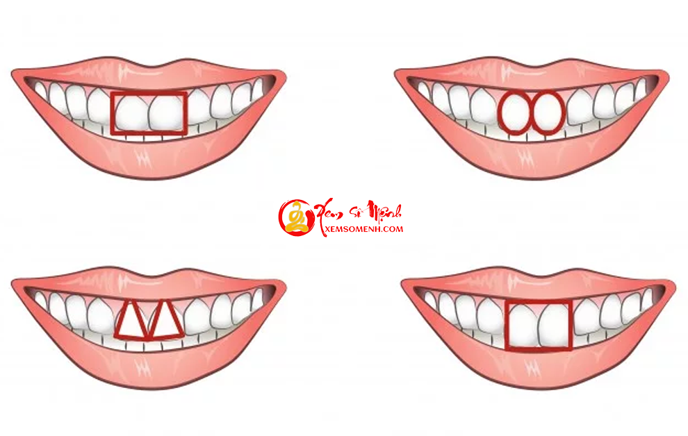 Cặp răng cửa “tố” bản chất con người thực sự của bạn