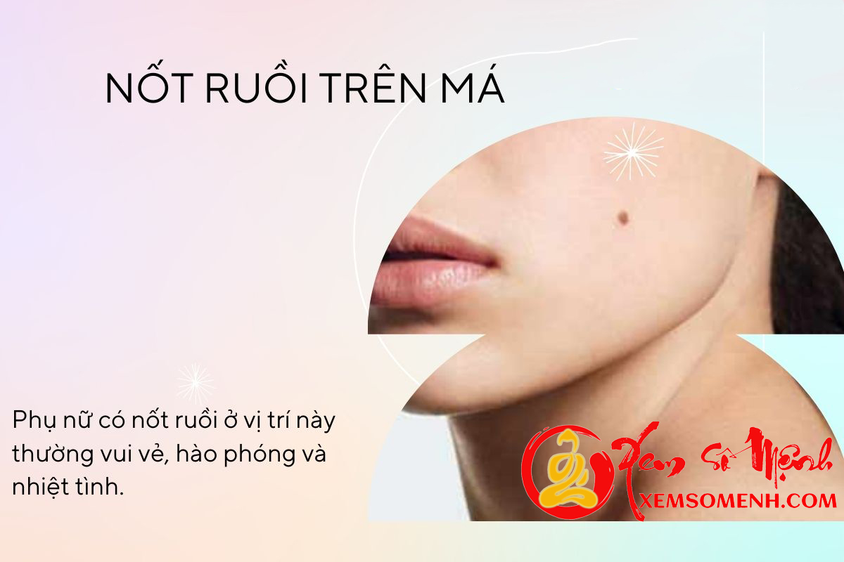 Not ruoi dao hoa o ma phu nu