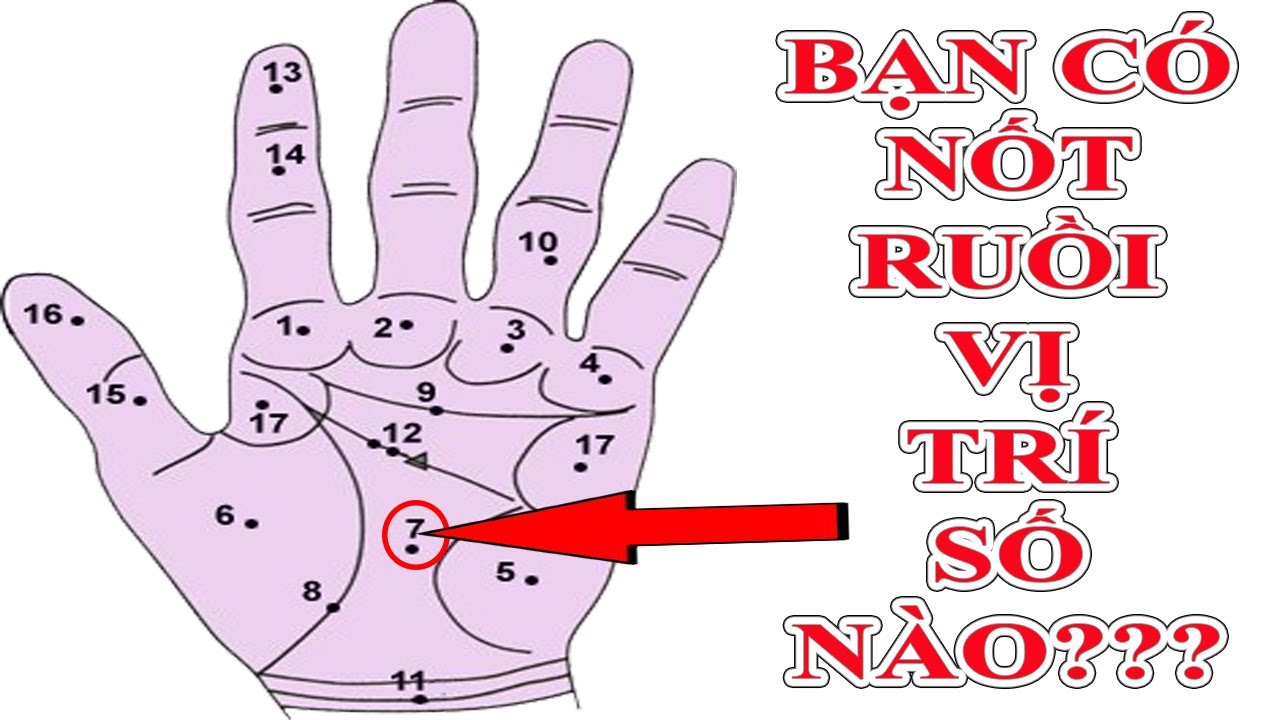 Vị trí nốt duồi trong lòng bàn tay