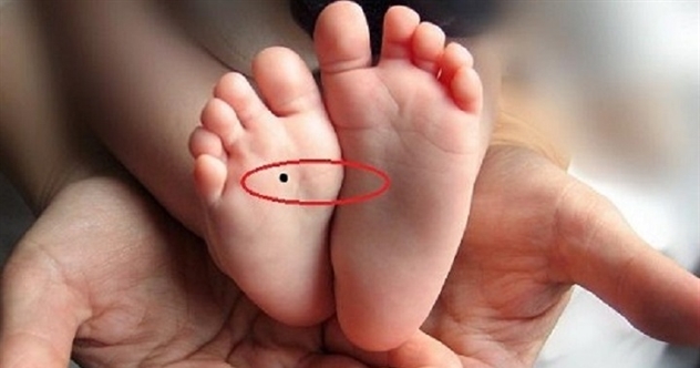 Ý nghĩa nốt ruồi ở lòng bàn chân
