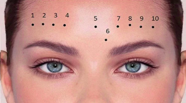 Xem Bói Nốt Ruồi Ở Trán Có Ý Nghĩa Tốt Xấu Như Thế Nào