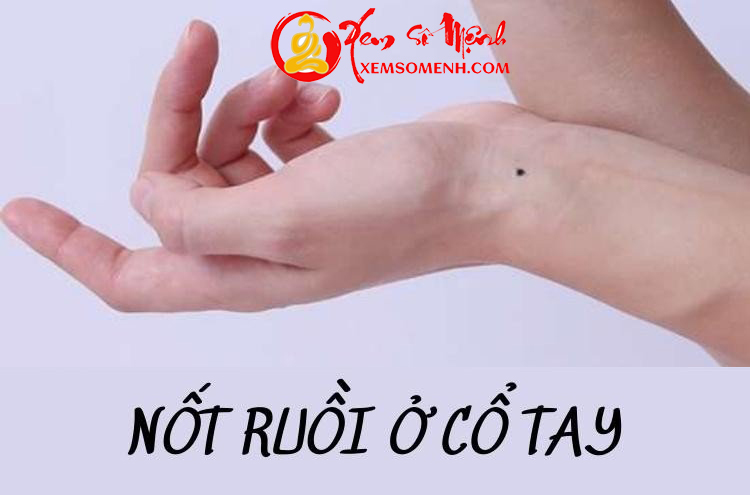 Nốt ruồi ở cổ tay có ý nghĩa gì đặc biệt?