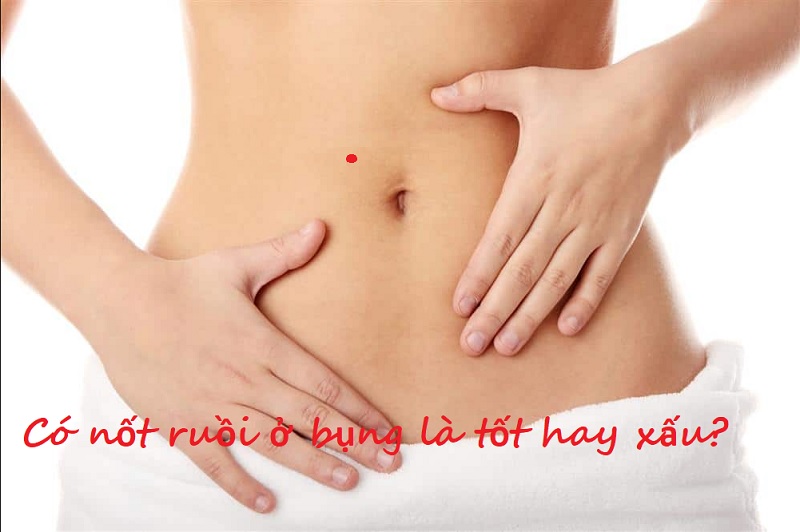 Nốt ruồi ở bụng có ý nghĩa gì